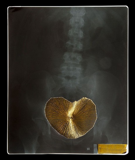 BRONWYN LACE, Silver and Gold IV
2015, X-RAY, Gold Thread, Perspex and LED Light